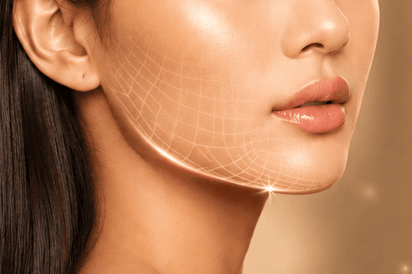 Facelift