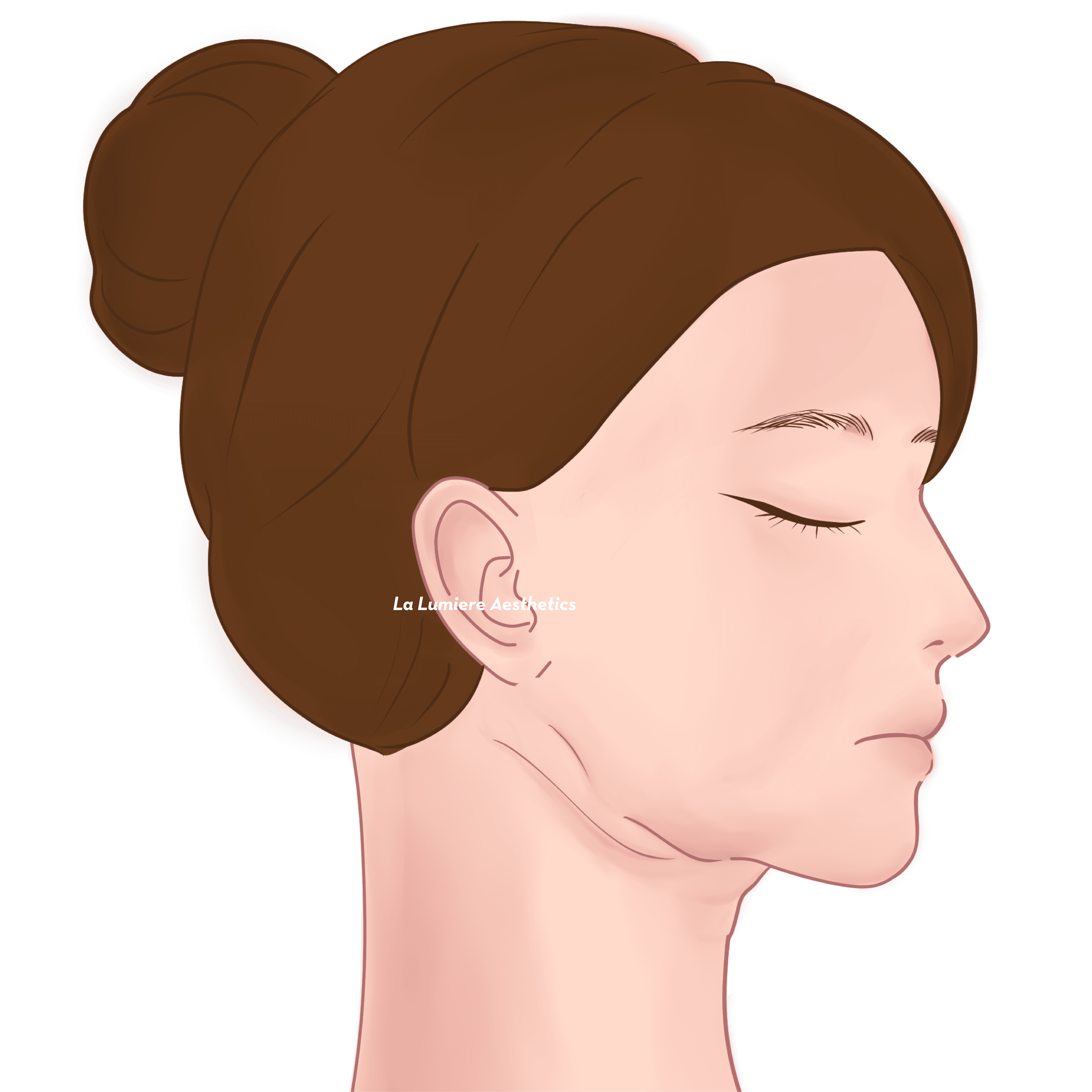 Prosedur Facelift Langkah 01