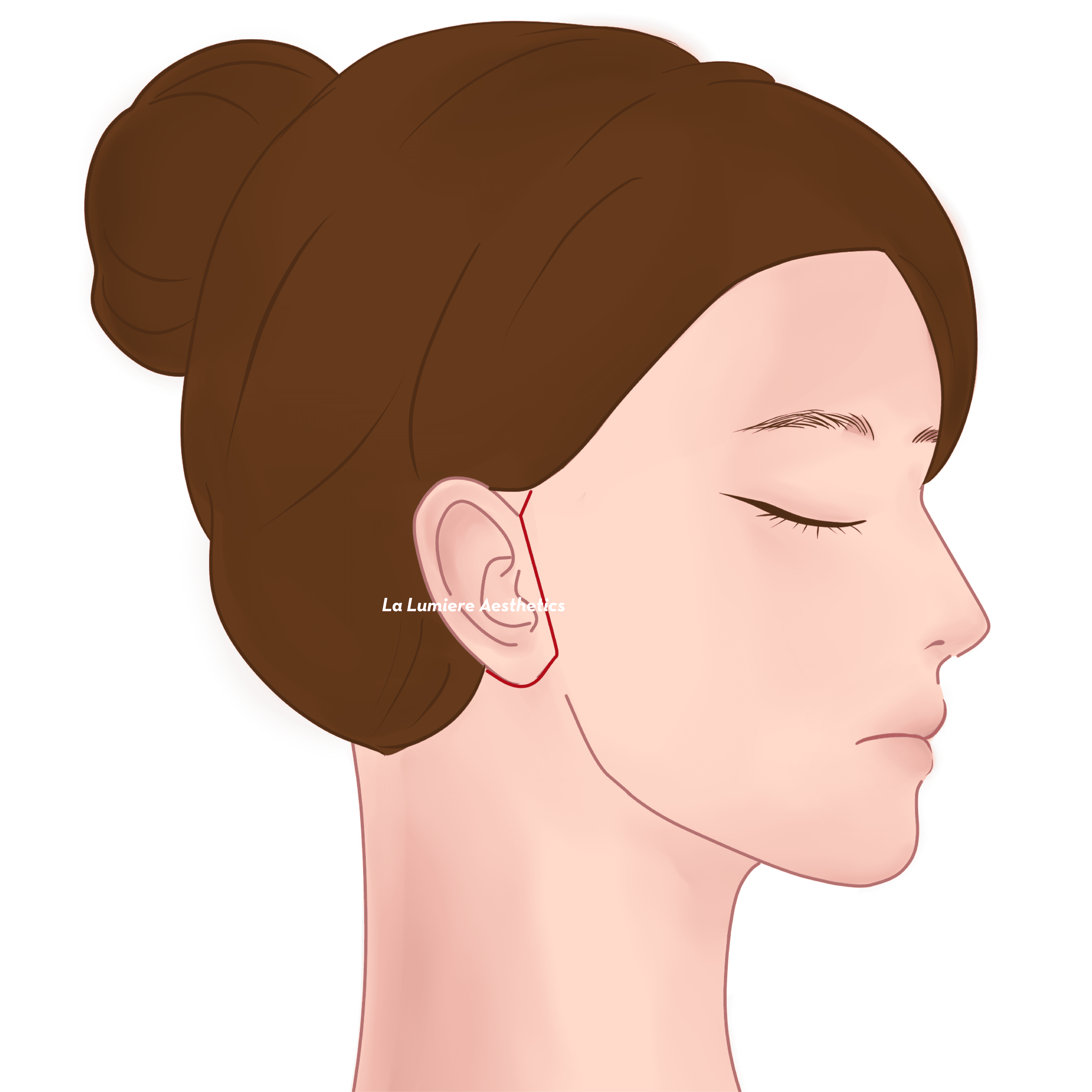 Prosedur Facelift Langkah 05